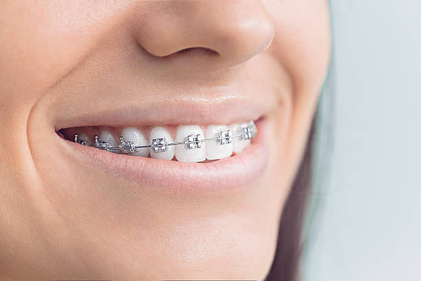 Best Full Mouth Reconstruction  in Ben Wheeler, TX